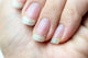 Brittle, peeling nails