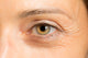 Fine lines/crow’s feet look sharper